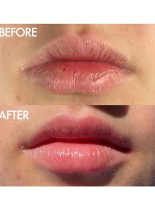 Багатоцільовий супербальзам lanolips the original 101 ointment multipurpose