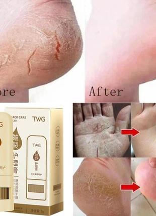 Крем для рук против высыхания трещин для ног ремонт пятки трещины удаление омертвевшей кожи мозоли отбеливание увлажнение уход за кожей рук ног