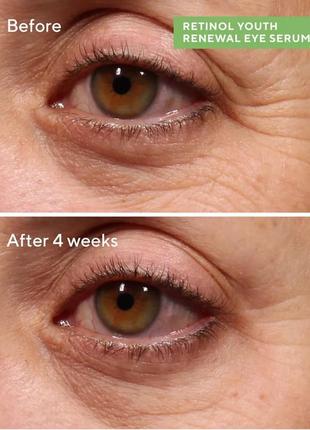 Мощная омолаживающая сыворотка для кожи вокруг глаз retinol youth renewal eye serum