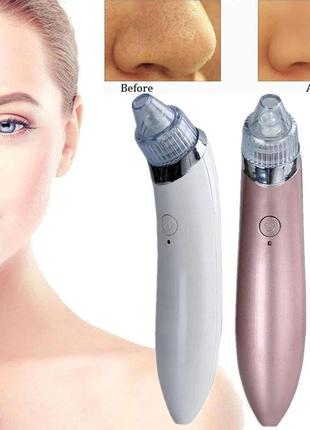 Вакуумний апарат для чищення пор beauty skin care specialist xn-8030