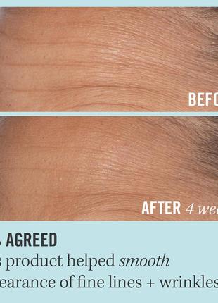 Сыворотка с коллагеном и пептидами first aid beauty bounce-boosting serum