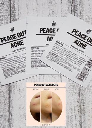 Peace out salicylic acid acne day dots локальний пластир від прищів