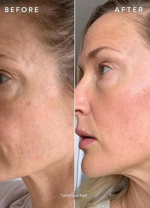 Увлажняющая антивозрастная сыворотка chebula active immunity serum от true botanicals, 5 мл