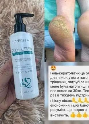Гель-кератолітик для видалення мозолів і натоптишів,огрубінь на стопах рідке лізо livesta