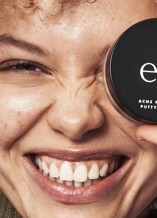 Праймер для борьбы с прыщами с салициловой кислотой acne fighting putty primer- 1.8%...