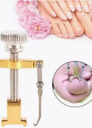 Устройство для коррекции и лечения вросшего ногтя корректор вросшего ногтя,...