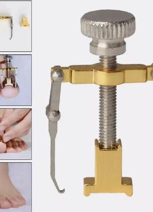 Устройство для коррекции и лечения вросшего ногтя корректор вросшего ногтя,...