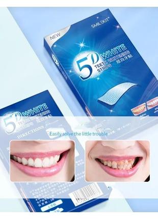 5d полоски для отбеливания зубов гель  удаление пятен налета гигиена полости рта чистка