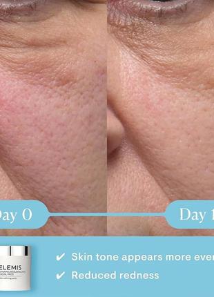 Диски для шлифовки кожи elemis dynamic resurfacing facial pads, 14 шт