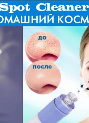 Spot cleaner — прилад для вакуумного чищення обличчя від пор (спот клінер)