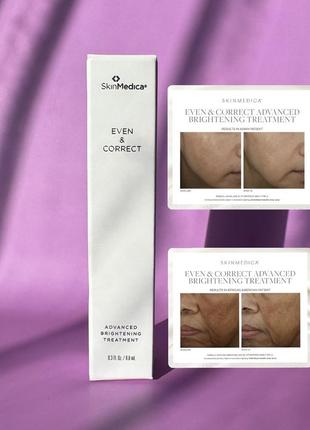 Сироватка від пігментації skinmedica even and correct advanced brightening treatment, 8.8ml
