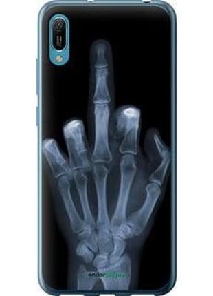Чохол на huawei y6 2019 рука через рентген "1007u-1666-10746"