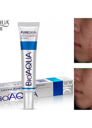 Крем для проблемной кожи анти-акне
