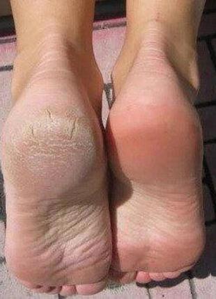 Электрическая роликовая пилка kemei km-2502