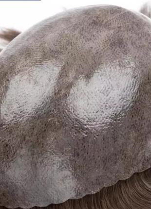 Система замещения волос..алопеция мужская.натуральный волос накладка парик протез.