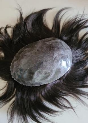 Система замещения волос..алопеция мужская.натуральный волос накладка парик протез.