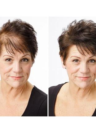 Кератиновая пудра для волос toppik для коррекции проблемных зон (залысин) шатен (medium brown)