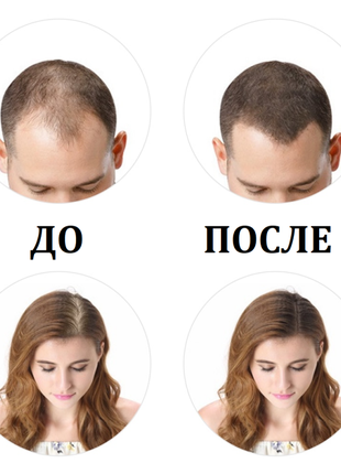 Кератиновая пудра для волос toppik для коррекции проблемных зон (залысин) шатен (medium brown)