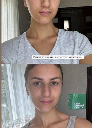 Lym drain detox 8