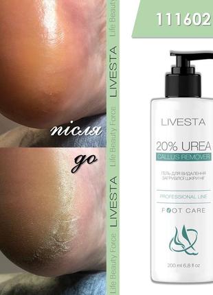 Гель кератолитик для стоп