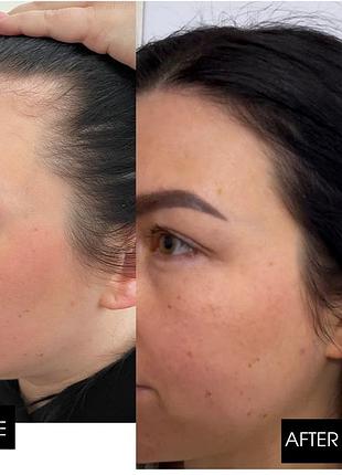 Шампунь против выпадения волос hillary serenoa &amp; гг hair loss control shampoo, 250 мл