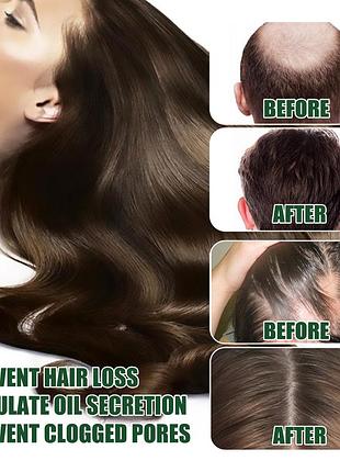 Сыворотка масло для роста волос от облысения секущихся кончиков