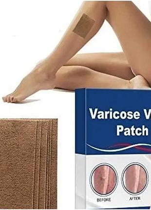 Пластир проти варикозу від болю та набряків у ногах varicose veins patch 10 шт лікувальний пластир