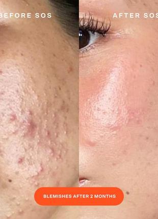 Спрей для лица с хлорноватистой кислотой tower 28 beauty sos daily rescue facial spray...