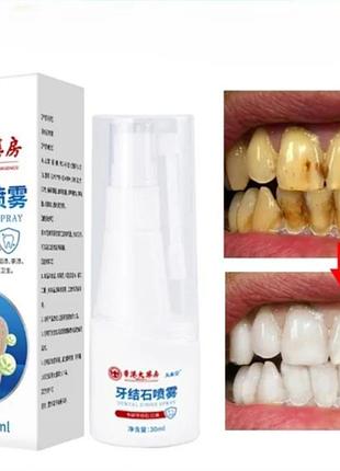 Новинка спрей для отбеливания зубов зубного налета