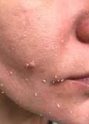 Пилинг-гель для лица farmstay real deep clear peeling gel