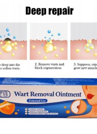 Китайская мазь папилломы, бородавки, мозоли