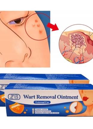 Китайская мазь папилломы, бородавки, мозоли