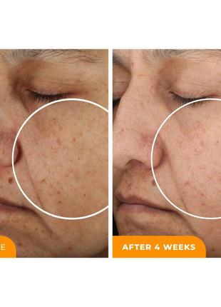 Антиоксидантна сироватка beautystat universal c skin refiner