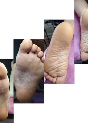 Крем-пенка baehr с клотримазолом и 10%-ной мочевиной (cremeschaum) 125мл