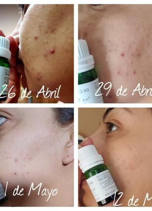 Уникальная сыворотка dr. c. tuna tea tree sos с маслом чайного дерева фармаси