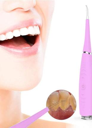 Скалер ультразвуковий очищувач зубів від каменю dental calculus remove rose