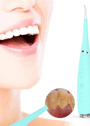 Скалер ультразвуковий очищувач зубів від каменю dental calculus remove green