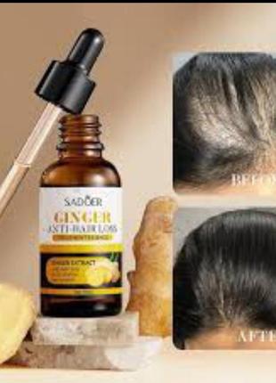 Сыворотка от выпадения волос и для укрепления корней sadoer ginger anti-hair loss с экстрактом имбиря😍❤️👍