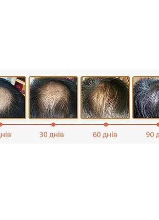 Масло для роста волос с имбирем и женьшеня sevich 20 мл