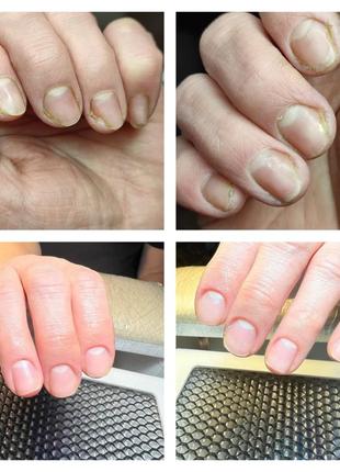 Лікувальне масло для нігтів і шкіри 7мл baehr