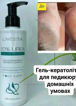 Гель-кератолітик для видалення загрубілої шкіри і натоптишів livesta, 200 мл