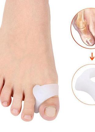 Силиконовый пальцевый корректор элайнер кольцо hallugs valgus white