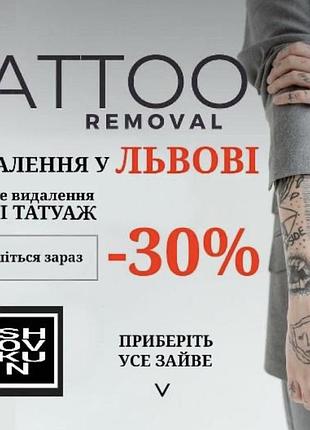 Лазерне видалення тату і татуажу у львові,лазерное удаление тату