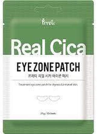 Патчі для зони навколо очей prreti vitalizing real cica, 30 шт