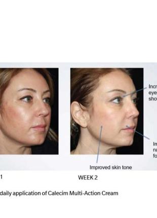 Антивозрастное средство calecim professional multi-action cream 50г/1,76oz cша3 фото