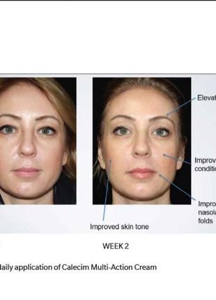 Антивозрастное средство calecim professional multi-action cream 50г/1,76oz cша4 фото