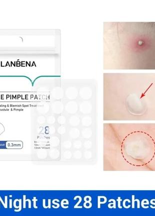 Гидроколоидные патчи от прыщей и угрей против акне ночные lanbena acne pimple patch