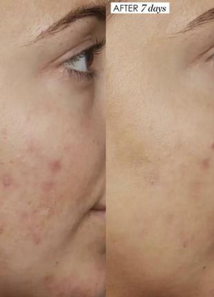 Сыворотка с ниацинамидом sunday riley b3 nice 10% niacinamide serum3 фото