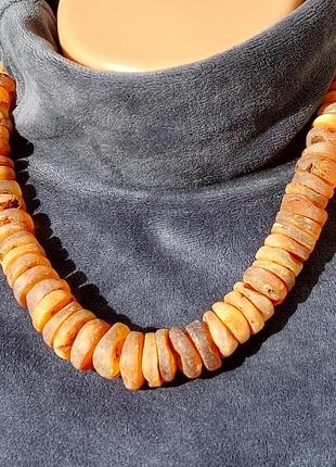 Янтарное ожерельясто крупные медовые шайбы, лечебное янтарное ожерельное медовое шайбы