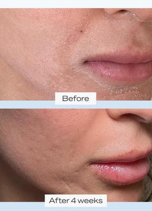Інтенсивно зволожувальний заспокійливий крем first aid beauty ultra repair cream intense hydration